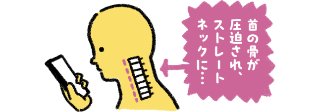 首の骨が圧迫され、ストレートネックに・・・