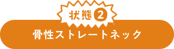 状態２ 骨性ストレートネック