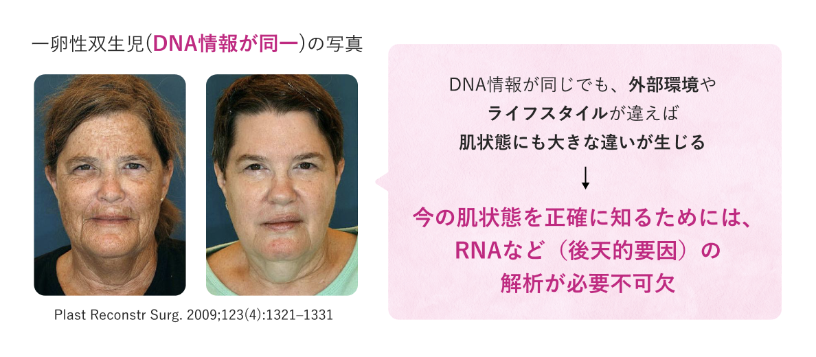 一卵性双生児(DNA情報が同一)の写真
